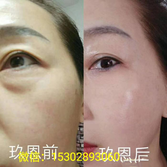 1604567339967702.png 3.jpg